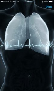 لباس هوشمند Hexoskin-01